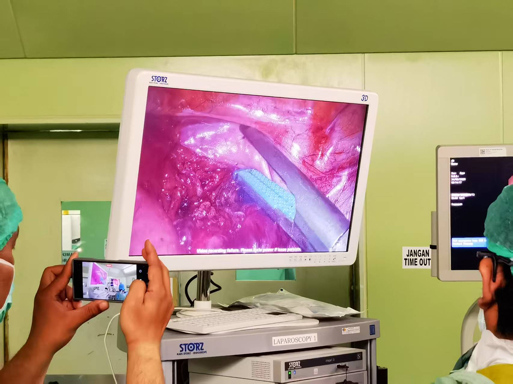 CAK Medical Device in the Operating Room