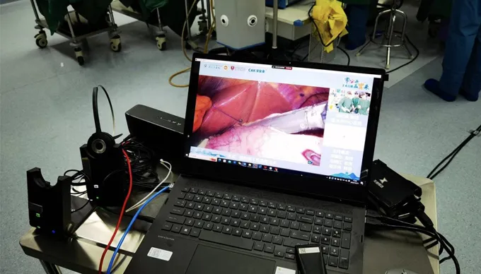 CAK-chirurgische Hefter in sechs Live-Operationen in ganz China